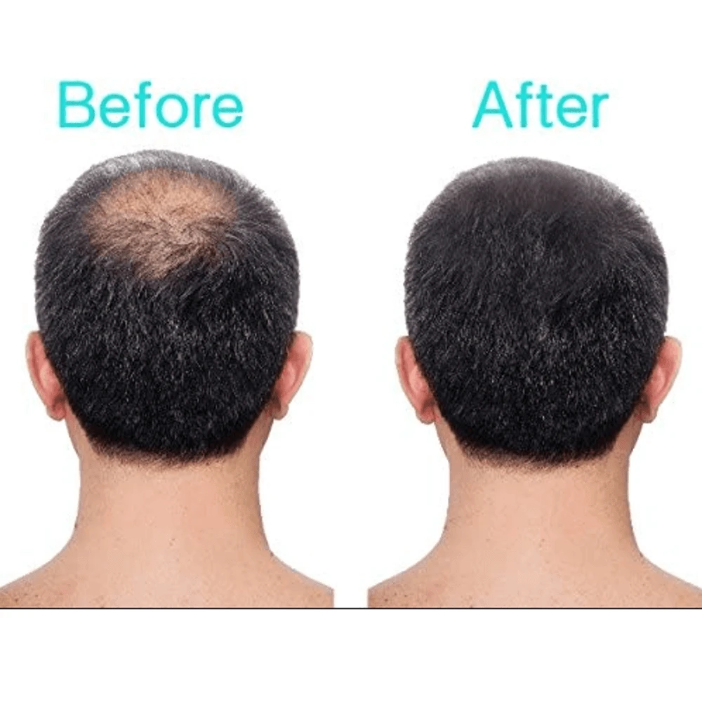 3D Hair Fibres โ Dark Grey - Image 2